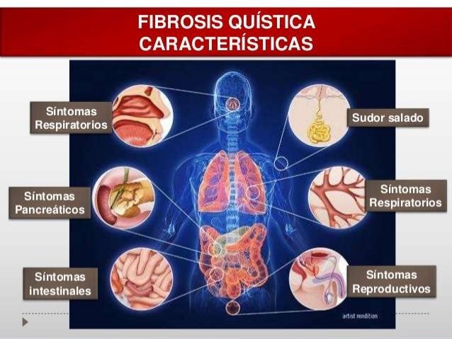 Enfermedad Fibroquistica Del Pancreas Pdf