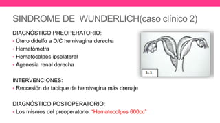 SINDROME DE WUNDERLICH(caso clínico 2)
DIAGNÓSTICO PREOPERATORIO:
• Útero didelfo a D/C hemivagina derecha
• Hematómetra
• Hematocolpos ipsolateral
• Agenesia renal derecha
INTERVENCIONES:
• Reccesión de tabique de hemivagina más drenaje
DIAGNÓSTICO POSTOPERATORIO:
• Los mismos del preoperatorio: “Hematocolpos 600cc”
 