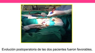 Evolución postoperatoria de las dos pacientes fueron favorables.
 