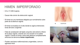 HIMEN IMPERFORADO
• 0.5 a 1/1,000 mujeres.
• Causa más común de obstrucción vaginal.
• El himen es una membrana delgada que normalmente cubre
parte de la abertura vaginal.
• El himen se localiza en el sitio donde la vagina embrionaria
brota del seno urogenital.
• Falta de canalización del tejido conjuntivo del extremo inferior
de la placa vaginal, creando así una oclusión en la salida
vaginal. Cuando el himen cubre esta abertura completamente
entonces se denomina himen imperforado.
• Pueden asociarse malformaciones urogenitales, como la
agenesia renal
 