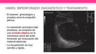 HIMEN IMPERFORADO: DIAGNÓSTICO Y TRATAMIENTO
• El examen ginecologico y
pruebas como la ecografía
pélvica
• La reparación quirúrgica bajo
anestesia, se compone de
una incisión elíptica en la
membrana cerca del anillo
himeneal, por evacuación del
material obstruido.
• La recuperación es muy
sencilla y rápida.
 