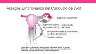 Rezagos Embrionarios del Conducto de Wolf
 
