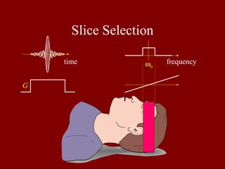 Slice Selection
ω0
time frequency
G
 