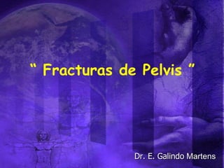 “  Fracturas de Pelvis ” Dr. E. Galindo  Martens 