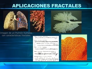 APLICACIONES FRACTALES Imagen de un Pulmón humano con características fractales 