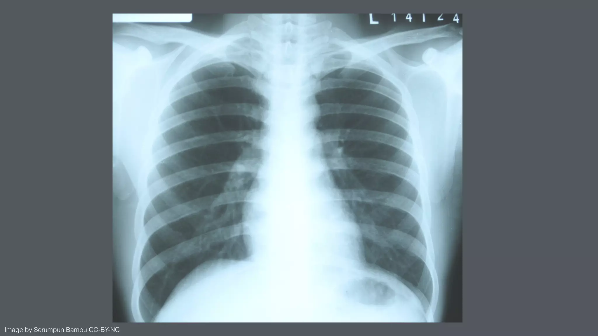 Image by Serumpun Bambu CC-BY-NC
 