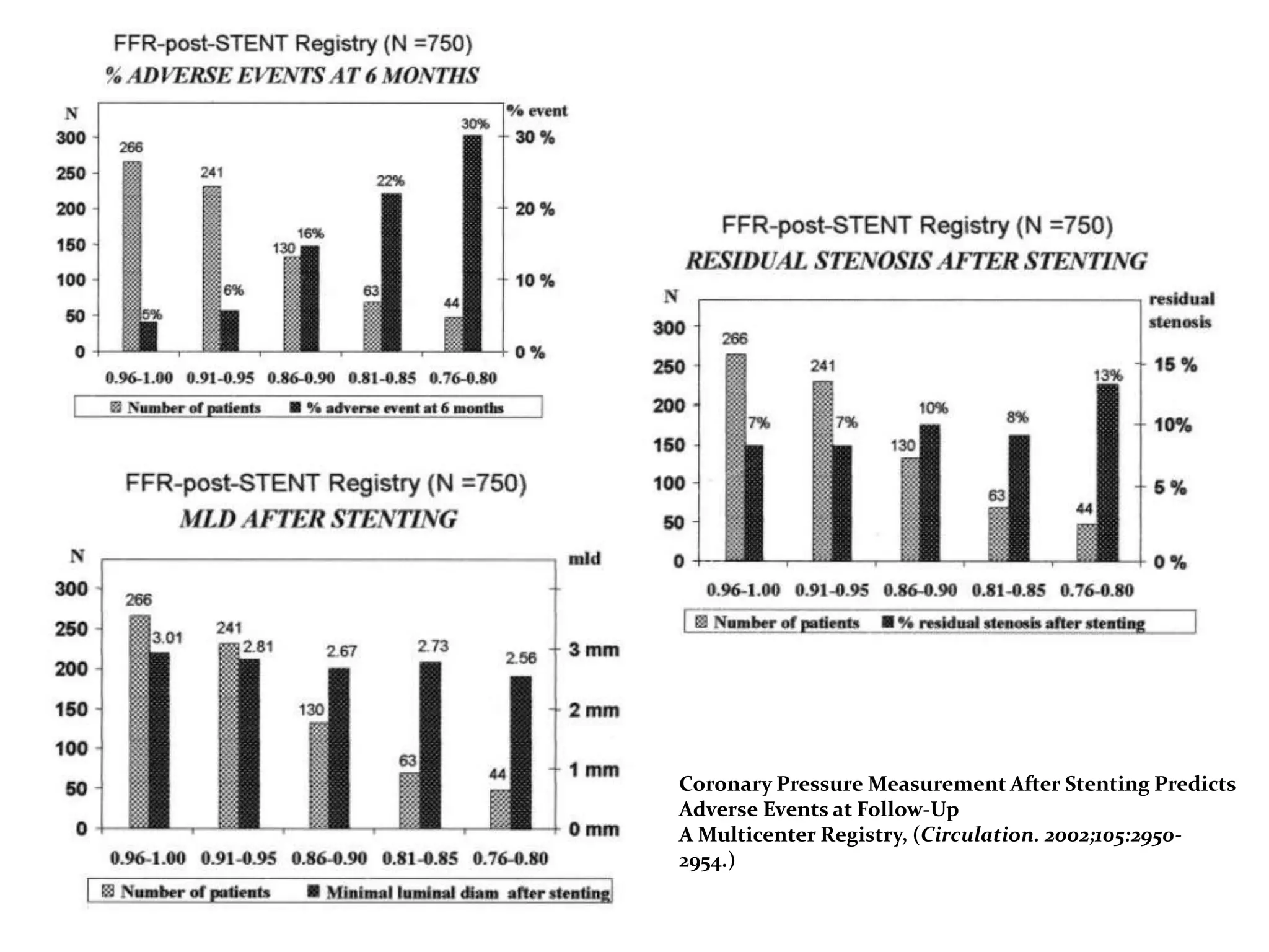 Coronary Pressure Measurement After Stenting Predicts
Adverse Events at Follow-Up
A Multicenter Registry, (Circulation. 2002;105:2950-
2954.)
 
