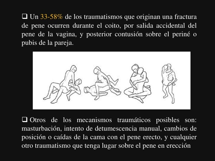 Rápidamente y cualitativamente aumentar el miembro