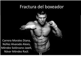 Fractura del boxeador
Carrera Morales Diana,
Núñez Alvarado Alexis,
Méndez Solórzano Jaxell,
Návar Méndez Raúl.
 