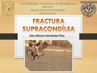 Alex Alfonso Hernández Rios
UNIVERSIDAD NACIONAL AUTÓNOMA DE
MÉXICO
FACULTAD DE MEDICINA
ORTOPEDIA
 