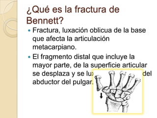 ¿Qué es la fractura de
Bennett?
 Fractura, luxación oblicua de la base
  que afecta la articulación
  metacarpiano.
 El fragmento distal que incluye la
  mayor parte, de la superficie articular
  se desplaza y se luxa por la acción del
  abductor del pulgar.
 