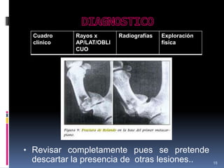 15
Cuadro
clínico
Rayos x
AP/LAT/OBLI
CUO
Radiografías Exploración
física
• Revisar completamente pues se pretende
descartar la presencia de otras lesiones..
 