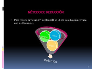 • Para reducir la ”luxación” de Bennett se utiliza la reducción cerrada
con las técnica de :
18
 