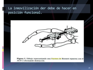 25
La inmovilización der debe de hacer en
posición funcional.
 