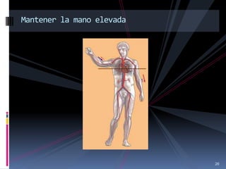 26
Mantener la mano elevada
 