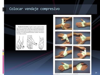 29
Colocar vendaje compresivo
 