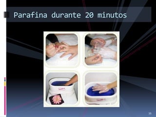 35
Parafina durante 20 minutos
 