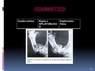 48
Cuadro clínico Rayos x
AP/LAT/OBLICU
O
Exploración
física
 