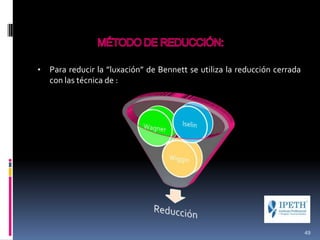• Para reducir la ”luxación” de Bennett se utiliza la reducción cerrada
con las técnica de :
49
 