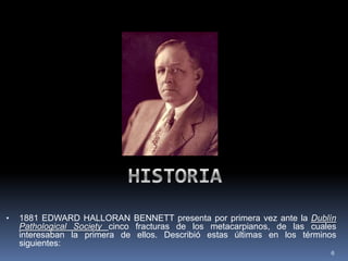 6
• 1881 EDWARD HALLORAN BENNETT presenta por primera vez ante la Dublín
Pathological Society cinco fracturas de los metacarpianos, de las cuales
interesaban la primera de ellos. Describió estas últimas en los términos
siguientes:
 
