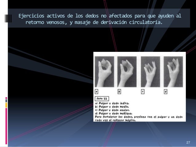 Fractura rolando