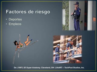 Factores de riesgoDeportes EmpleosDe: (1997) 3DSuper Anatomy. Cleveland, OH: LifeART – TechPool Studios, Inc.