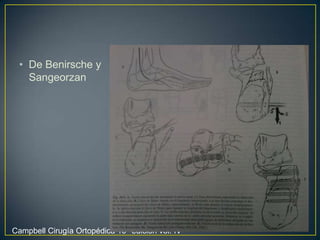 De Benirsche y SangeorzanCampbell Cirugía Ortopédica 10° edición vól. IV