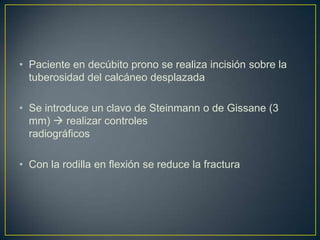 Paciente en decúbito prono se realiza incisión sobre la tuberosidad del calcáneo desplazadaSe introduce un clavo de Steinmann o de Gissane (3 mm)  realizar controles 				        radiográficos Con la rodilla en flexión se reduce la fractura  
