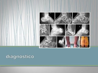 diagnostico