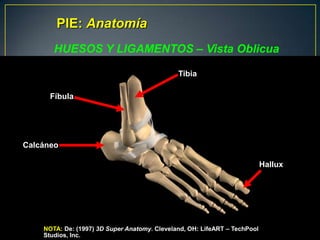 PIE: AnatomíaHUESOS Y LIGAMENTOS – Vista OblicuaTibiaFíbulaCalcáneoHalluxNOTA: De: (1997) 3DSuper Anatomy. Cleveland, OH: LifeART – TechPool Studios, Inc.