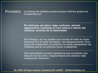 De: (1997) 3DSuper Anatomy. Cleveland, OH: LifeART – TechPool Studios, Inc.