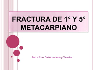 FRACTURA DE 1° Y 5°
  METACARPIANO



     De La Cruz Gutiérrez Nancy Yomaira
 