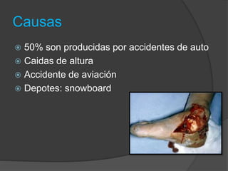 Causas
 50% son producidas por accidentes de auto
 Caidas de altura
 Accidente de aviación
 Depotes: snowboard
 