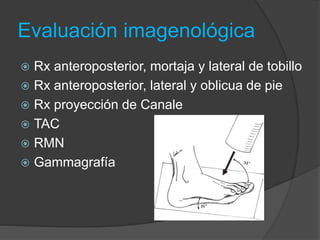 Evaluación imagenológica
 Rx anteroposterior, mortaja y lateral de tobillo
 Rx anteroposterior, lateral y oblicua de pie
 Rx proyección de Canale
 TAC
 RMN
 Gammagrafía
 