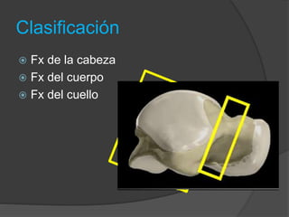 Clasificación
 Fx de la cabeza
 Fx del cuerpo
 Fx del cuello
 