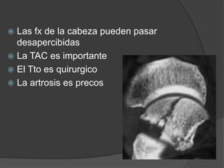  Las fx de la cabeza pueden pasar
desapercibidas
 La TAC es importante
 El Tto es quirurgico
 La artrosis es precos
 