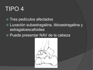TIPO 4
 Tres pedículos afectados
 Luxación subastragalina, tibioastragalina y
astragaloescafoidea
 Puede presentar NAV de la cabeza
 