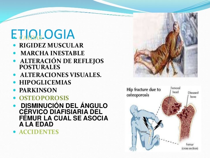 Dolor de espalda alta hombre