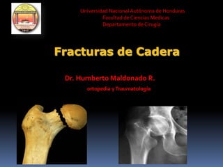 Universidad Nacional Autónoma de Honduras
Facultad de Ciencias Medicas
Departamento de Cirugía

Fracturas de Cadera
Dr. Humberto Maldonado R.
ortopedia y Traumatología

 