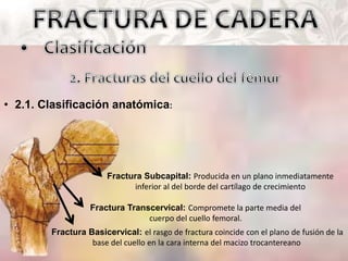 • 2.1. Clasificación anatómica:
Fractura Subcapital: Producida en un plano inmediatamente
inferior al del borde del cartílago de crecimiento
Fractura Transcervical: Compromete la parte media del
cuerpo del cuello femoral.
Fractura Basicervical: el rasgo de fractura coincide con el plano de fusión de la
base del cuello en la cara interna del macizo trocantereano
 