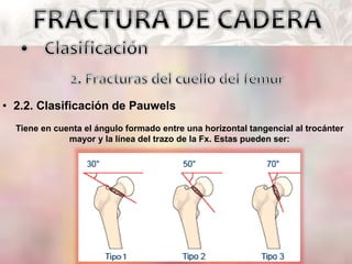 • 2.2. Clasificación de Pauwels
Tiene en cuenta el ángulo formado entre una horizontal tangencial al trocánter
mayor y la línea del trazo de la Fx. Estas pueden ser:
 