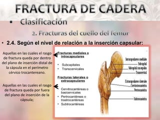 • 2.4. Según el nivel de relación a la inserción capsular:
Aquellas en las cuales el rasgo
de fractura queda por dentro
del plano de inserción distal de
la cápsula en el perímetro
cérvico trocantereano.
Aquellas en las cuales el rasgo
de fractura queda por fuera
del plano de inserción de la
cápsula;
 