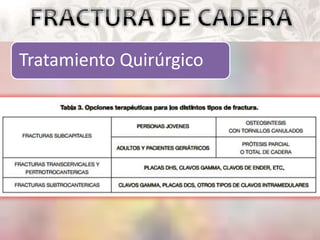 Tratamiento Quirúrgico
 