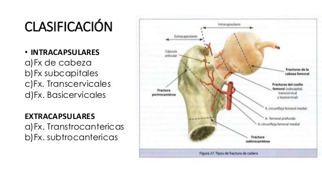 sexo