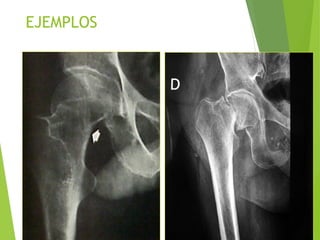 EJEMPLOS
 