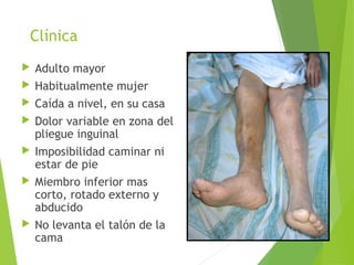Clínica
 Adulto mayor
 Habitualmente mujer
 Caída a nivel, en su casa
 Dolor variable en zona del
pliegue inguinal
 Imposibilidad caminar ni
estar de pie
 Miembro inferior mas
corto, rotado externo y
abducido
 No levanta el talón de la
cama
 