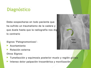 Diagnóstico
Debe sospecharse en todo paciente que
ha sufrido un traumatismo de la cadera y
que duele hasta que la radiografía nos diga
lo contrario
Signos ‘Patognomonicos’:
 Acortamiento
 Rotación externa
Otros Signos:
 Tumefacción y equimosis posterior muslo y región glútea
 Intenso dolor palpación trocantérica y movilización
 