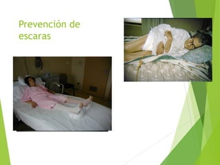 Prevención de
escaras
 