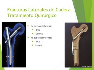 Fracturas Laterales de Cadera
Tratamiento Quirúrgico
 Fx pertrocantéreas:
 DHS
 Gamma
 Fx subtrocantéreas:
 DCS
 Gamma
 