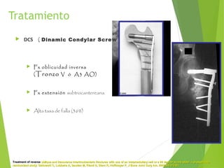 Tratamiento
 DCS ( Dinamic Condylar Screw )
 Fx oblicuidad inversa
(Tronzo V ó A3 AO)
 Fx extensión subtrocantereana
 Alta tasa de falla (36%)
Treatment of reverseTreatment of reverse oblique and transverse intertrochanteric fractures with use of an intramedullary nail or a 95 degree screw-plate: a prospective,oblique and transverse intertrochanteric fractures with use of an intramedullary nail or a 95 degree screw-plate: a prospective,
randomized study. Sadowski C, Lubbeke A, Saudan M, Riand N, Stern R, Hoffmeyer P. J Bone Joint Surg Am. 2002;84:372-81.randomized study. Sadowski C, Lubbeke A, Saudan M, Riand N, Stern R, Hoffmeyer P. J Bone Joint Surg Am. 2002;84:372-81.
 
